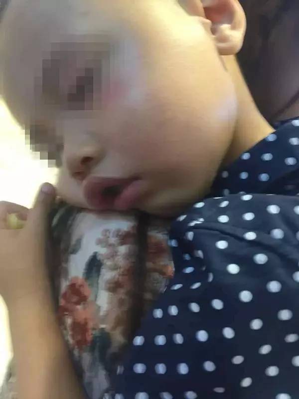 2歲娃被陌生女子毆打后腦勺著地鼻子出血 看了監控讓人后怕  監控新聞  第1張